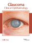 Glaucoma: Clinical Ophthalmology by Collin Cruz - Hardback