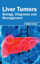 Liver Tumors: Biology, Diagnosis and Management by Dylan Long - Hardback