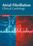 Atrial Fibrillation: Clinical Cardiology by Caleb Bell - Hardback