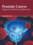 Prostate Cancer: Diagnosis, Treatment and Recovery by Samantha Cross - Hardback Prostate Cancer: Diagnosis, Treatment and Recovery by Samantha Cross - Hardback