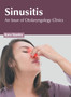 Sinusitis: An Issue of Otolaryngology Clinics by Kara Stanley - Hardback