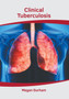 Clinical Tuberculosis by Megan Durham - Hardback