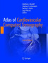 Atlas of Cardiovascular Computed Tomography by Matthew J. Budoff - Paperback