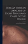 Eczema With an Analysis of Eight Thousand Cases of the Disease by Lucius Duncan 1845-1928 Bulkley - Hardback