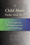 Child Abuse Pocket Atlas Series, Volume 4: Investigation, Documentation and Radiology by Randell Alexander - Paperback