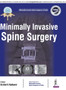 Minimally Invasive Spine Surgery by Arvind Kulkarni - Hardback