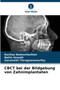 CBCT bei der Bildgebung von Zahnimplantaten by Kavitaa Nedunchezhian - Paperback
