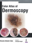 Color Atlas of Dermoscopy by Horacio Cabo - Hardback