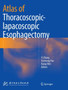 Atlas of Thoracoscopic-lapacoscopic Esophagectomy by Yi Zhang - Paperback