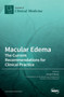 Macular Edema : The Current Recommendations for Clinical Practice by Gawecki Maciej - Hardback