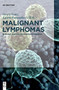 Malignant Lymphomas : Biology and Molecular Pathogenesis by Georg Lenz - Hardback