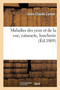 Maladies Des Yeux Et de la Vue, Cataracte, Loucherie by Jules-Claude Carnet - Paperback