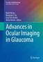 Advances in Ocular Imaging in Glaucoma by Rohit Varma - Hardback