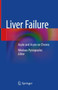 Liver Failure : Acute and Acute on Chronic by Nikolaos Pyrsopoulos - Hardback
