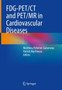 FDG-PET/CT and PET/MR in Cardiovascular Diseases by Matthieu Pelletier-Galarneau - Hardback FDG-PET/CT and PET/MR in Cardiovascular Diseases by Matthieu Pelletier-Galarneau - Hardback