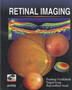 Retinal Imaging by Pradeep Venkatesh - Paperback
