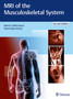 MRI of the Musculoskeletal System by Martin Vahlensieck - Hardback