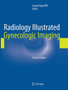 Radiology Illustrated: Gynecologic Imaging by Seung Hyup Kim - Paperback