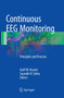 Continuous EEG Monitoring : Principles and Practice by Aatif M. Husain - Paperback
