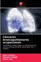 Canceres broncopulmonares ocupacionais by Amel Kchaou - Paperback