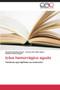 Ictus Hemorragico Agudo by Hernandez Reyes Anied - Paperback