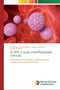 O HPV e suas manifestacoes clinicas by Fernanda Lima de Oliveira - Paperback
