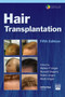 Hair Transplantation by Walter Unger - Hardback