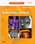 Gynecologic Imaging : Expert Radiology Series (Expert Consult Premium Edition - Enhanced Online Features and Print) by Julia R. Fielding - Hardback