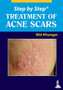 Step by Step: Treatment of Acne Scars by Niti Khunger - Paperback