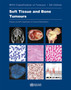 WHO classification of tumours of soft tissue and bone tumours : 3 by International Agency for Research on Cancer - Paperback