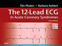 The 12-Lead ECG in Acute Coronary Syndromes : Pocket Reference for the 12-Lead ECG in Acute Coronary Syndromes by Tim Phalen - Hardback