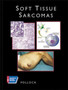 SOFT TISSUE SARCOMAS (AMERICAN CANCER SOCIETY ATLAS OF CLINICAL ONCOLOGY) by Pollock - Hardback