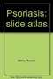 Psoriasis: slide atlas by Ronald Marks - Hardback