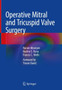 Operative Mitral and Tricuspid Valve Surgery by Narain Moorjani - Hardback