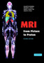 MRI from Picture to Proton by Donald W. McRobbie - Hardback