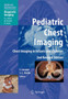 Pediatric Chest Imaging by Javier Lucaya - Paperback