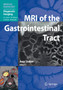 MRI of the Gastrointestinal Tract by Jaap Stoker - Paperback