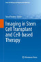 Imaging in Stem Cell Transplant and Cell-based Therapy by Tarun Pandey - Hardback