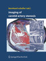 Imaging of Carotid Artery Stenosis by Bernhard Schaller - Hardback