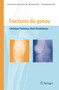 Fractures Du Genou by Christian Fontaine - Paperback