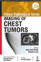 Clinico Radiological Series: Imaging of Chest Tumors by Ashu Seith Bhalla - Paperback