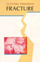 Fracture by Clayton Eshleman - Paperback
