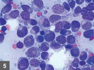 The Treatment & Diagnosis Of Cancer In Cats