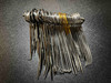 Stringer photo of V. Mueller OP101 Full Podiatry Instrument Set