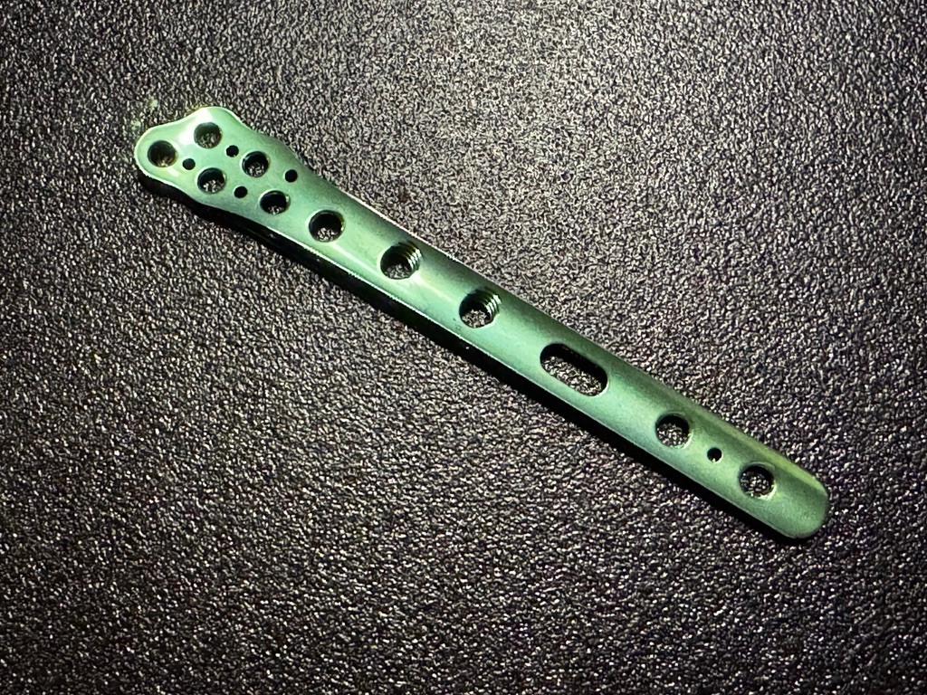 End photo of Acumed 7007-0106R Lateral Fibula Plate, 6-Hole, Right