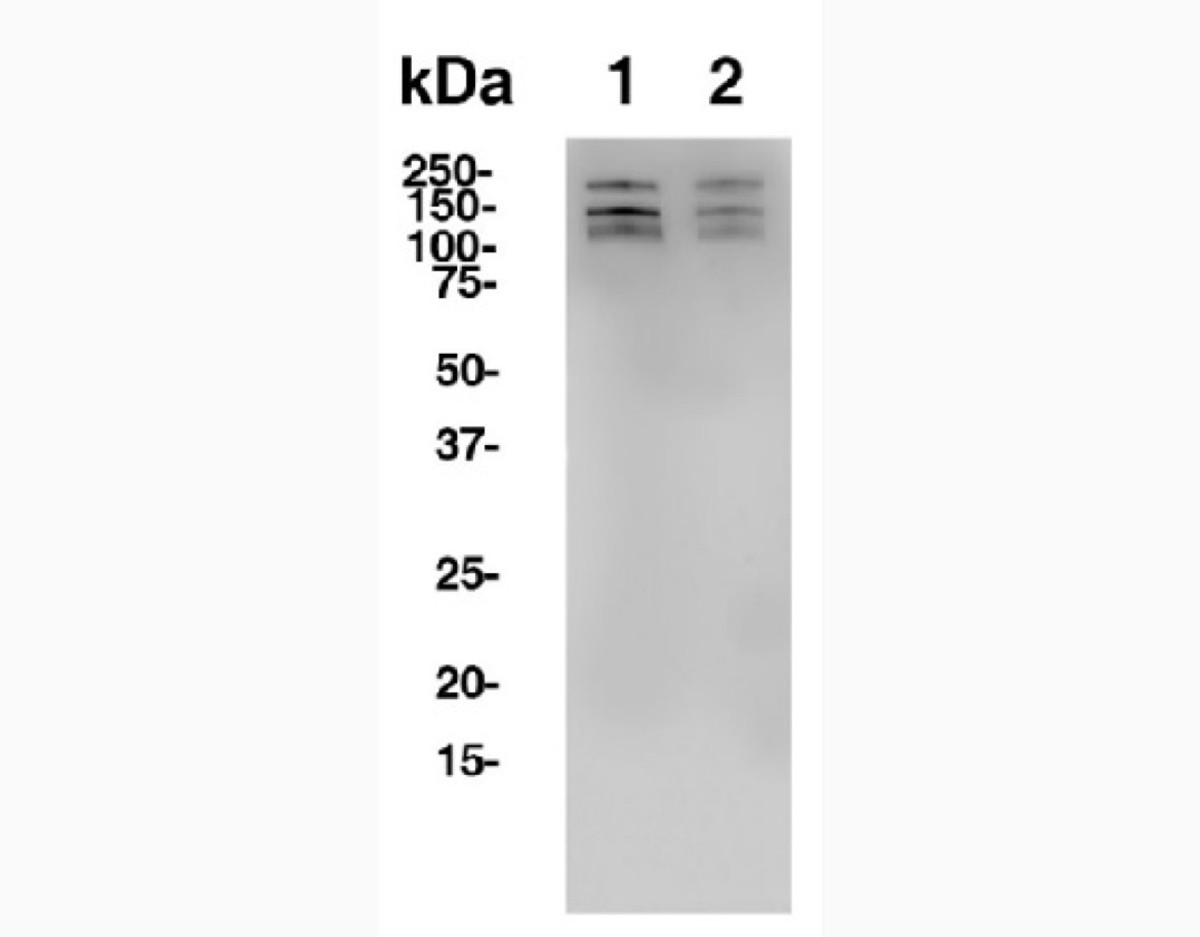 Bulk anti-Human CD56 antibody (ERIC-1) [ICH1015]