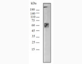 Western blot of ichorbio's nivolumab biosimilar for RUO