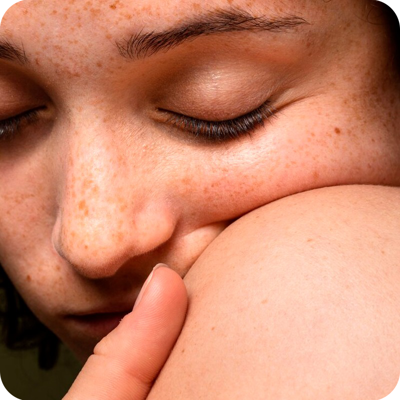 imagen cosmñetica personalizada