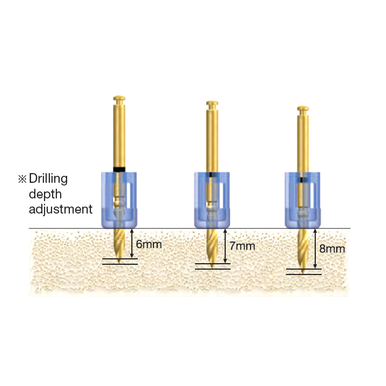 PARALLEL GUIDE KIT SINGLE GUIDE