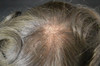 Mens Toupee HD111 8"x10" Thinnest Skin Base Hairpiece (1-2 Month Durability)
